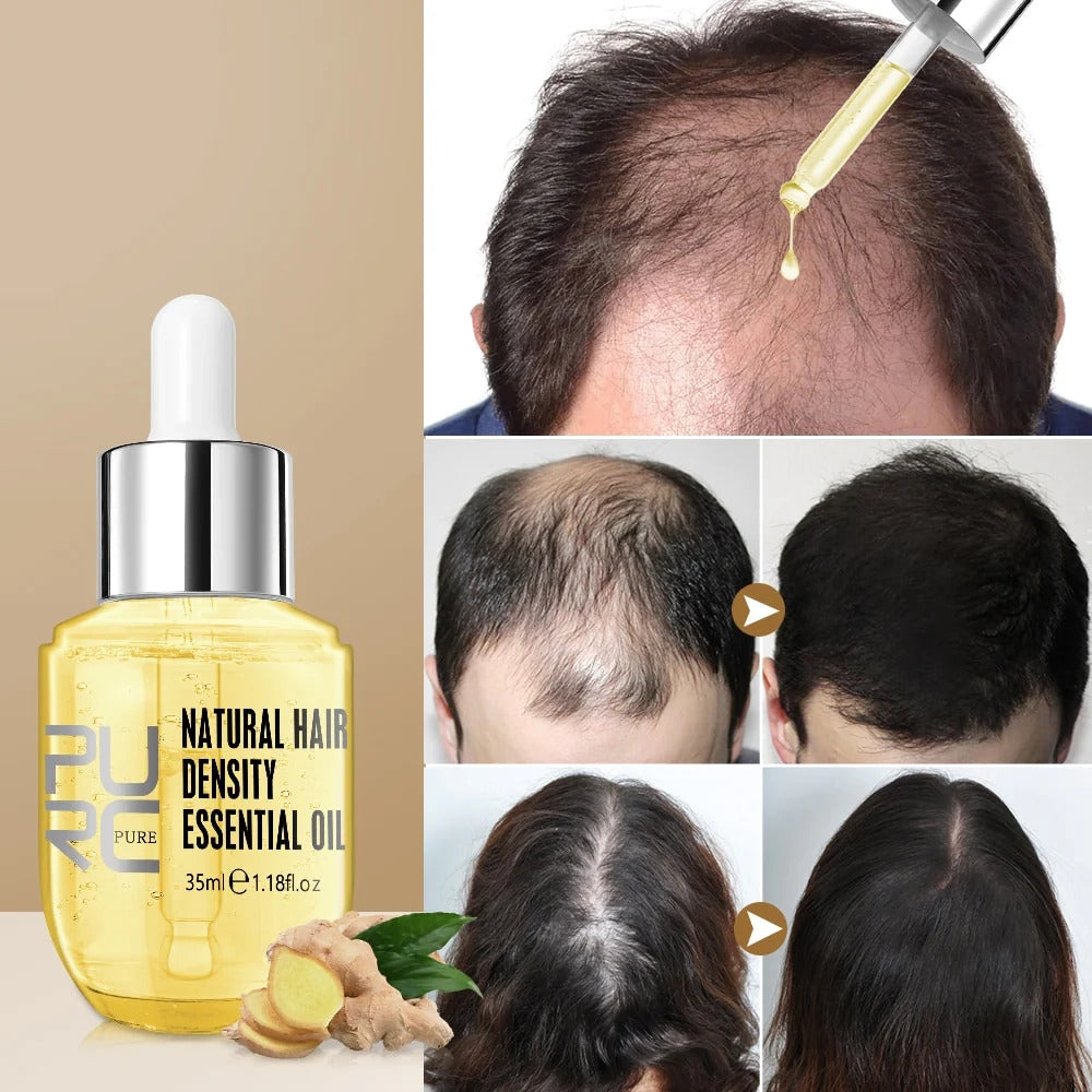 Last Day Promotion 70% OFF - 🔥 Hair Growth Oil